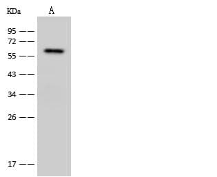 CHEK2 / CHK2 Antibody