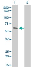ALPPL2 Antibody (clone 2B3)
