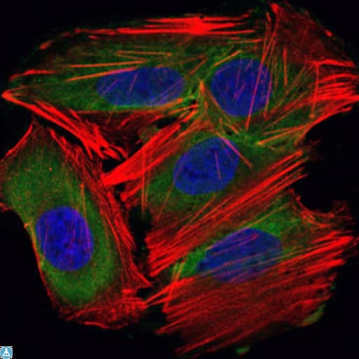 Monoclonal Mouse anti-Human UBE2I / UBC9 Antibody (IHC, IF, WB)