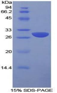 Human SLAMF1 / SLAM / CD150 Protein (Recombinant His-T7)