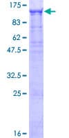 Human WDR75 Protein (Recombinant GST)