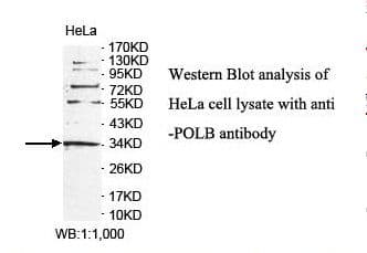 POLB / DNA Polymerase Beta Antibody (aa15-188)