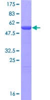 Human ING4 Protein (Recombinant GST)