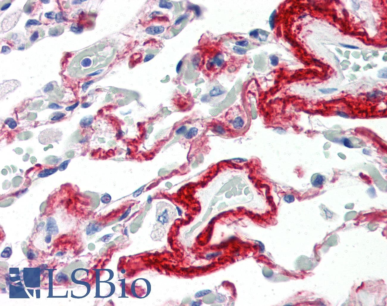 IHC-plus™ Monoclonal Mouse anti-Human TIMP3 Antibody (aa170-188, IHC, WB)