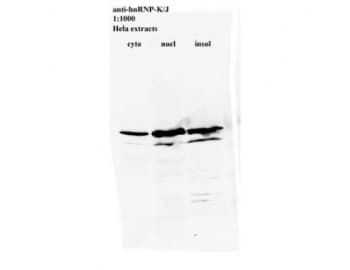 hnRNP K + J Antibody (clone 3C2)
