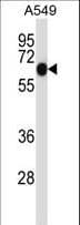 IHC-plus™ ALPPL2 Antibody (aa58-86)