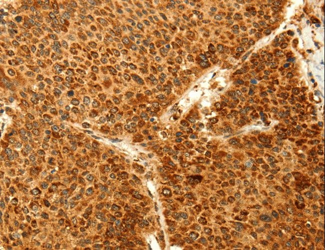 GRM3 / MGLUR3 Antibody