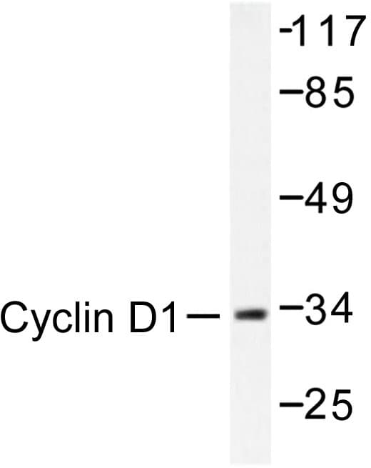 CCND1 / Cyclin D1 Antibody (Leu283)