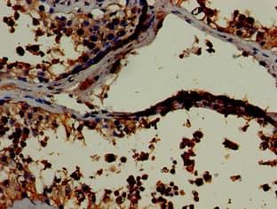 IHC-plus™ LDHC / Lactate Dehydrogenase C Antibody