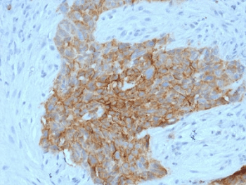 SLC2A1 / GLUT-1 Antibody (clone GLUT1/2475)