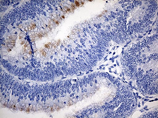 TFF1 / pS2 Antibody (aa25-84, clone OTI7B12)