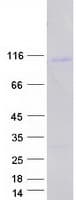 Human WT5 / POU6F2 Protein (Recombinant Myc-DDK (Flag))