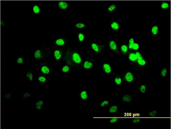 IHC-plus™ TDP-43 / TARDBP Antibody (clone 2E2-D3)