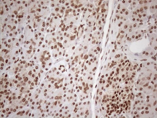 EXOSC1 / CSL4 Antibody (clone OTI4C7)
