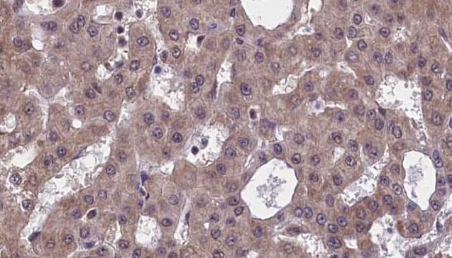 AP2A2 Antibody