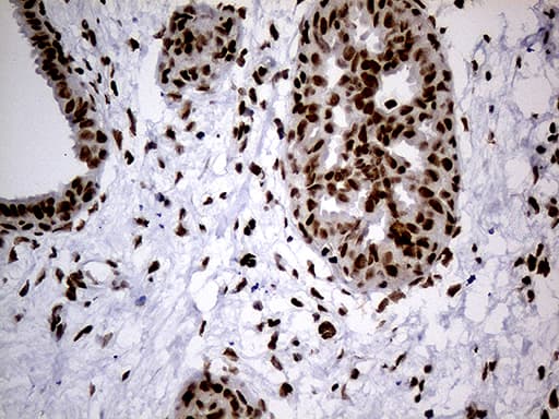 Monoclonal Mouse anti-Human SMC1A / SMC1 Antibody (clone OTI2D12, Carrier-free, aa889-1016, IHC, WB)