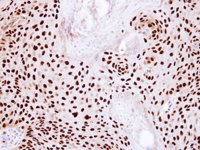 XRCC5 / Ku80 Antibody (aa315-593)