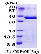 Human FAM84A Protein (Recombinant His)