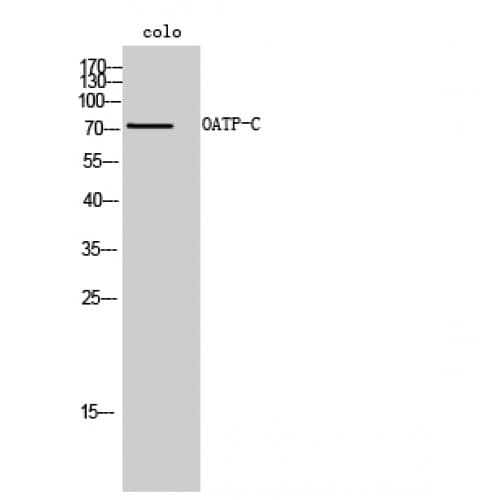 SLCO1B1 / OATP2 Antibody (220-300 aa, Internal)