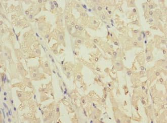 NME3 Antibody