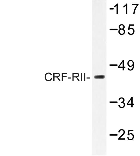 IHC-plus™ CRHR2 / CRF2 Receptor Antibody (His112)