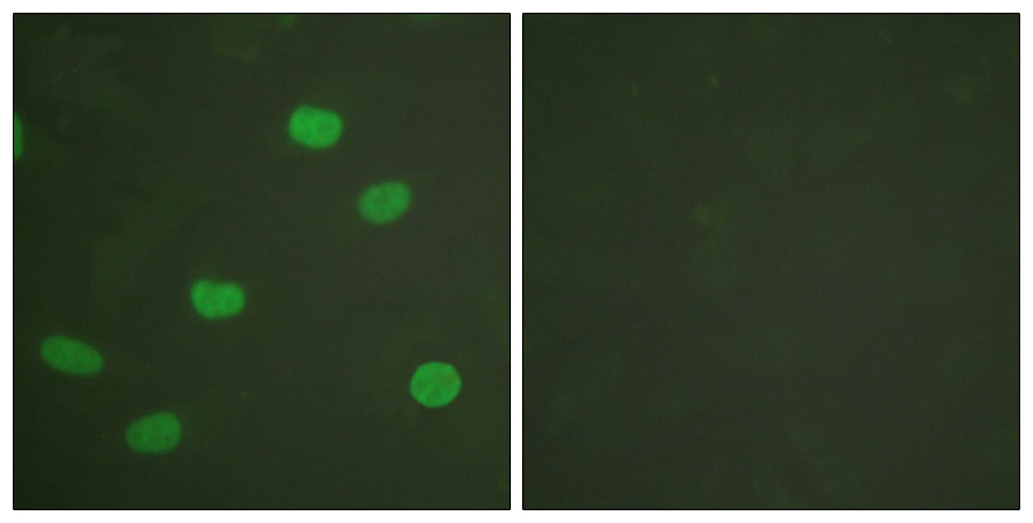 LMNA / Lamin A+C Antibody (phospho-Ser392)