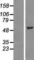 TTC19 Protein (Over-Expression Lysate Myc-DDK (Flag))