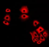 Polyclonal Rabbit anti-Human NCS1 / Neuronal Calcium Sensor Antibody (IF, WB)