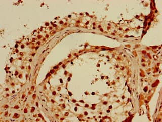 QIP1 / KPNA4 Antibody