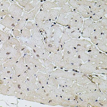 SET / TAF-I Antibody