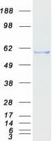 Human IPPK Protein (Recombinant Myc-DDK (Flag))