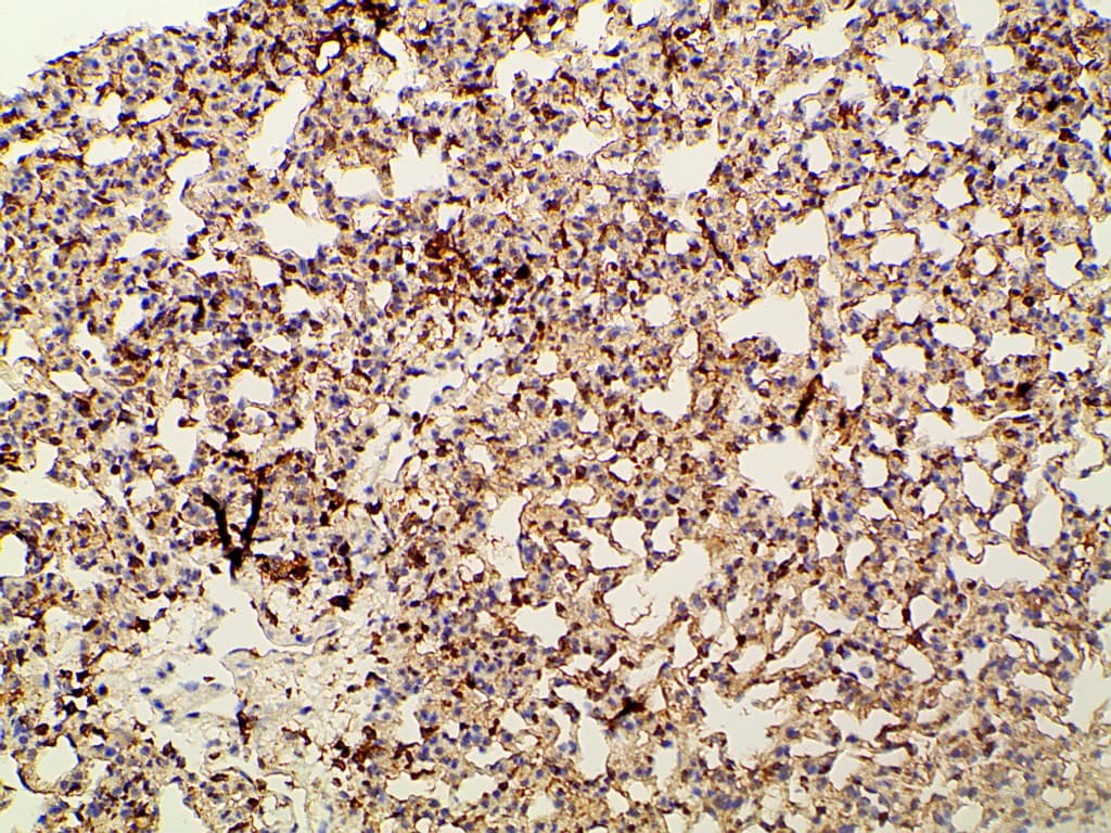 PIK3R1 / p85 Alpha Antibody (phospho-Tyr607)