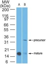 IL-1B / IL-1 Beta Antibody (clone 43N1G6)