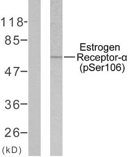 Polyclonal Rabbit anti-Human ER Alpha / Estrogen Receptor Antibody (phospho-Ser106, IHC, WB)