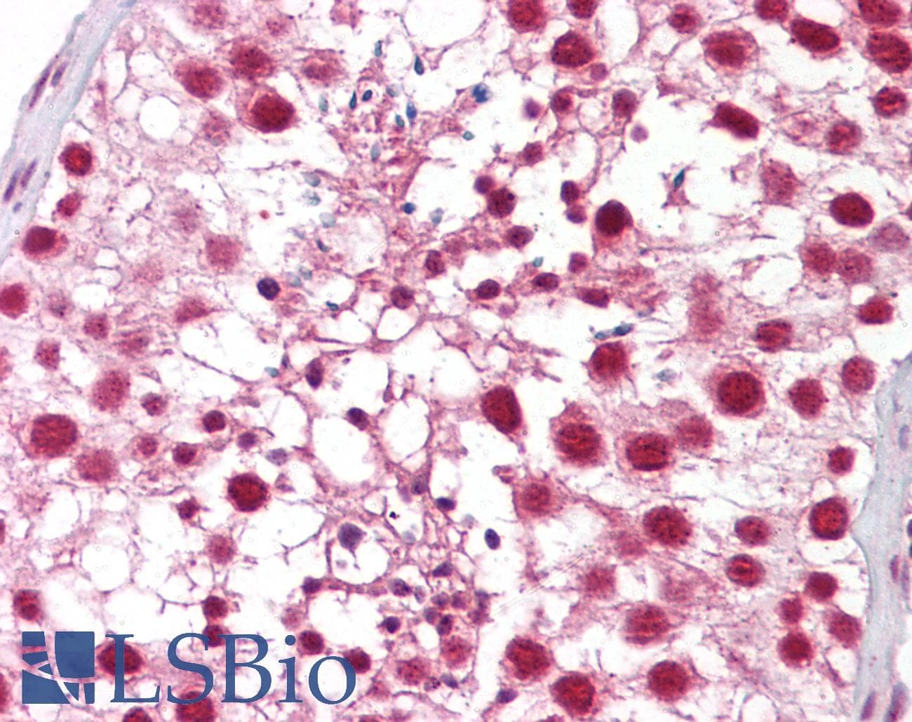 IHC-plus™ CTNNBL1 / NAP Antibody