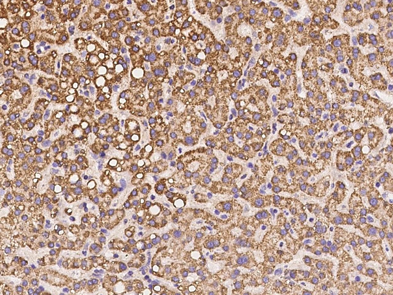 Polyclonal Rabbit anti-Human CLYBL Antibody (IHC)