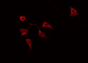 STAT6 Antibody