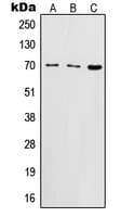 IL2RB / CD122 Antibody (N-Terminus)
