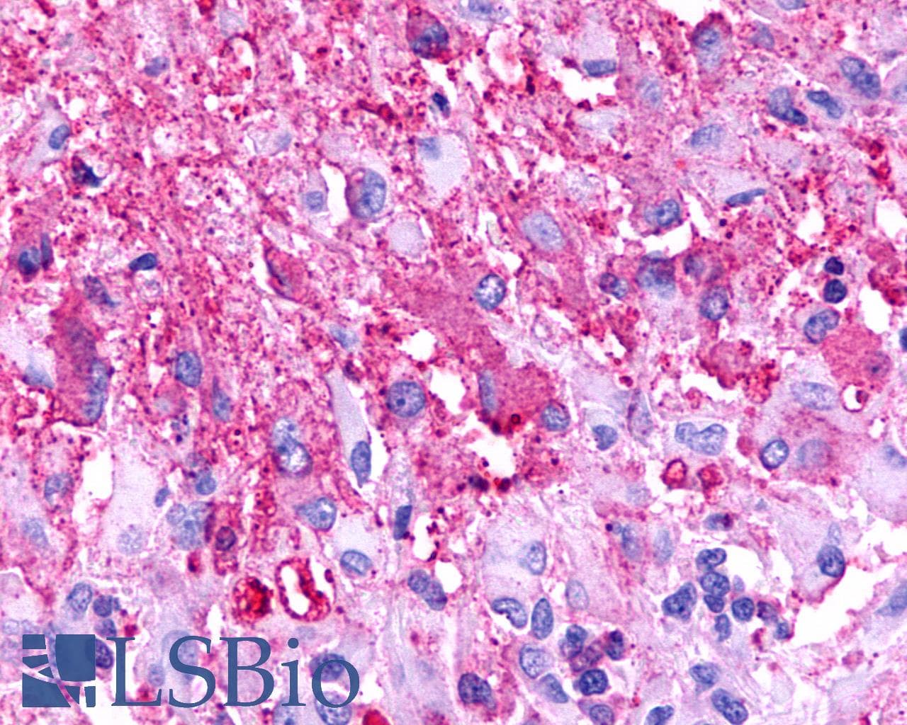IHC-plus™ Polyclonal Rabbit anti-Human TPRA1 / GPR175 Antibody (Cytoplasmic Domain, IHC)