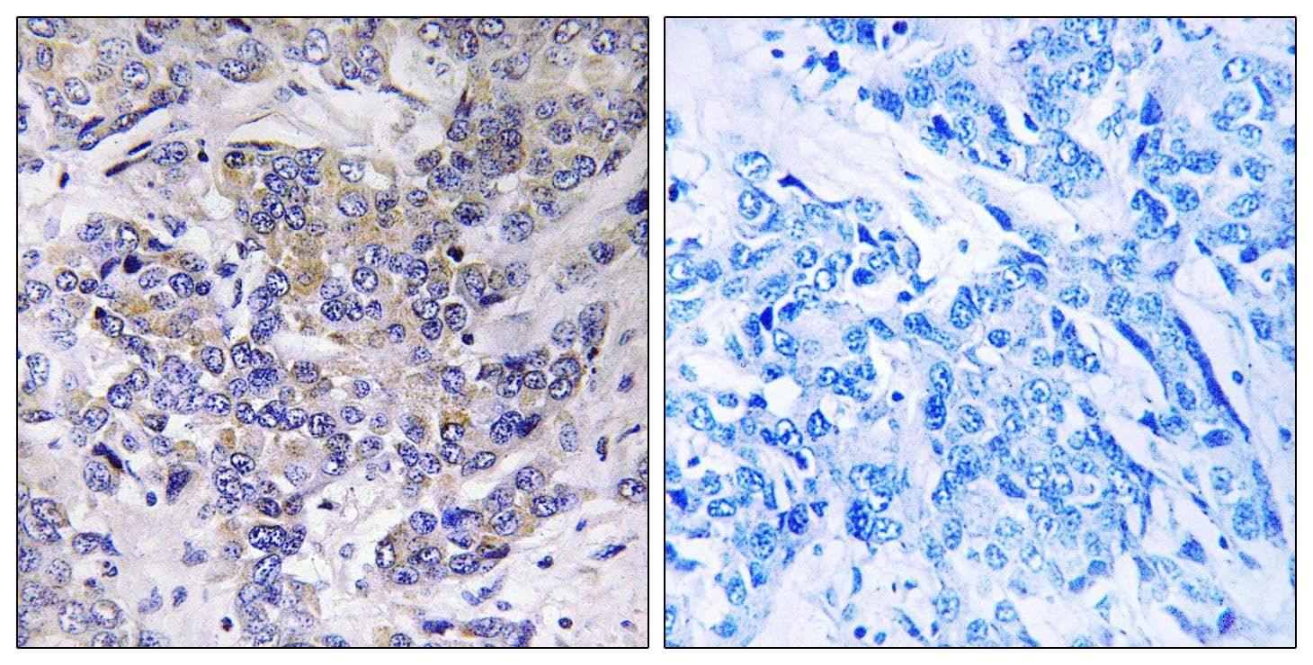 Polyclonal Rabbit anti-Human RPS21 / Ribosomal Protein S21 Antibody (IHC)