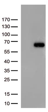 Monoclonal Mouse anti-Human FOXN2 Antibody (clone OTI7D12, aa1-431, WB)