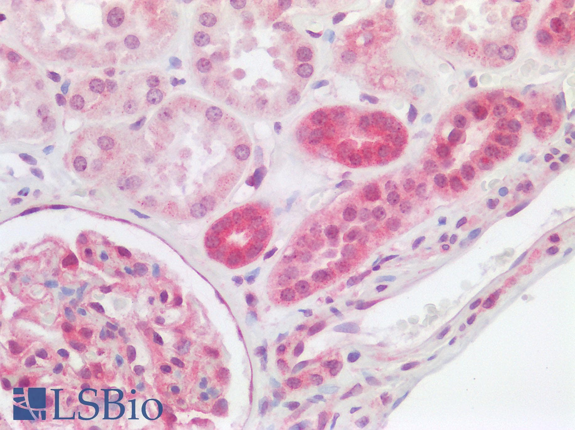 F3 / CD142 / Tissue factor Antibody