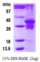 Human PSMB7 Protein (Recombinant His)