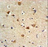 FCGR1A / CD64 Antibody (aa217-245)