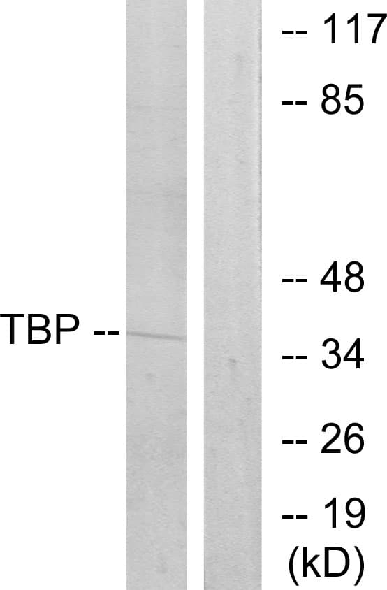TBP / GTF2D Antibody (aa151-200)