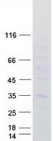 Human MARCH3 Protein (Recombinant Myc-DDK (Flag))