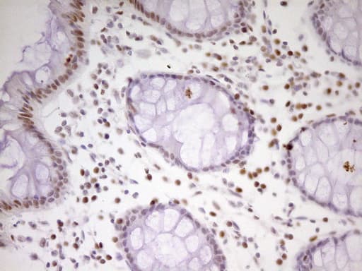 Monoclonal Mouse anti-Human MEF2D Antibody (clone OTI1E11, aa1-282, IHC, WB)