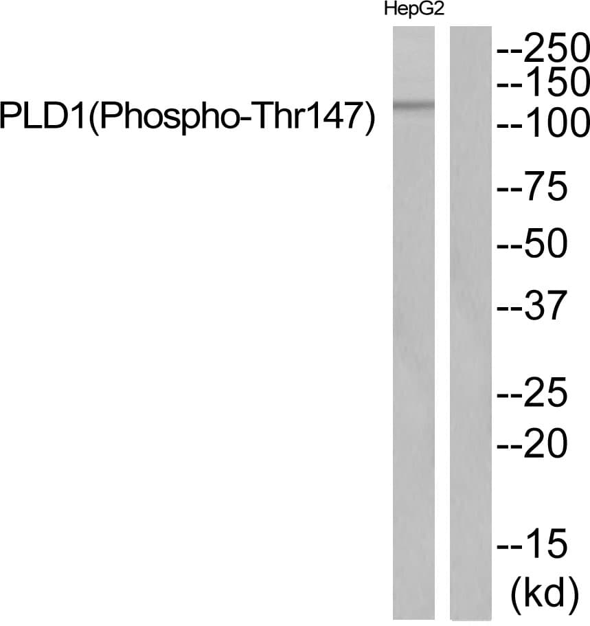 PLD1 / Phospholipase D1 Antibody (phospho-Thr147)