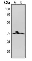 CD20 Antibody