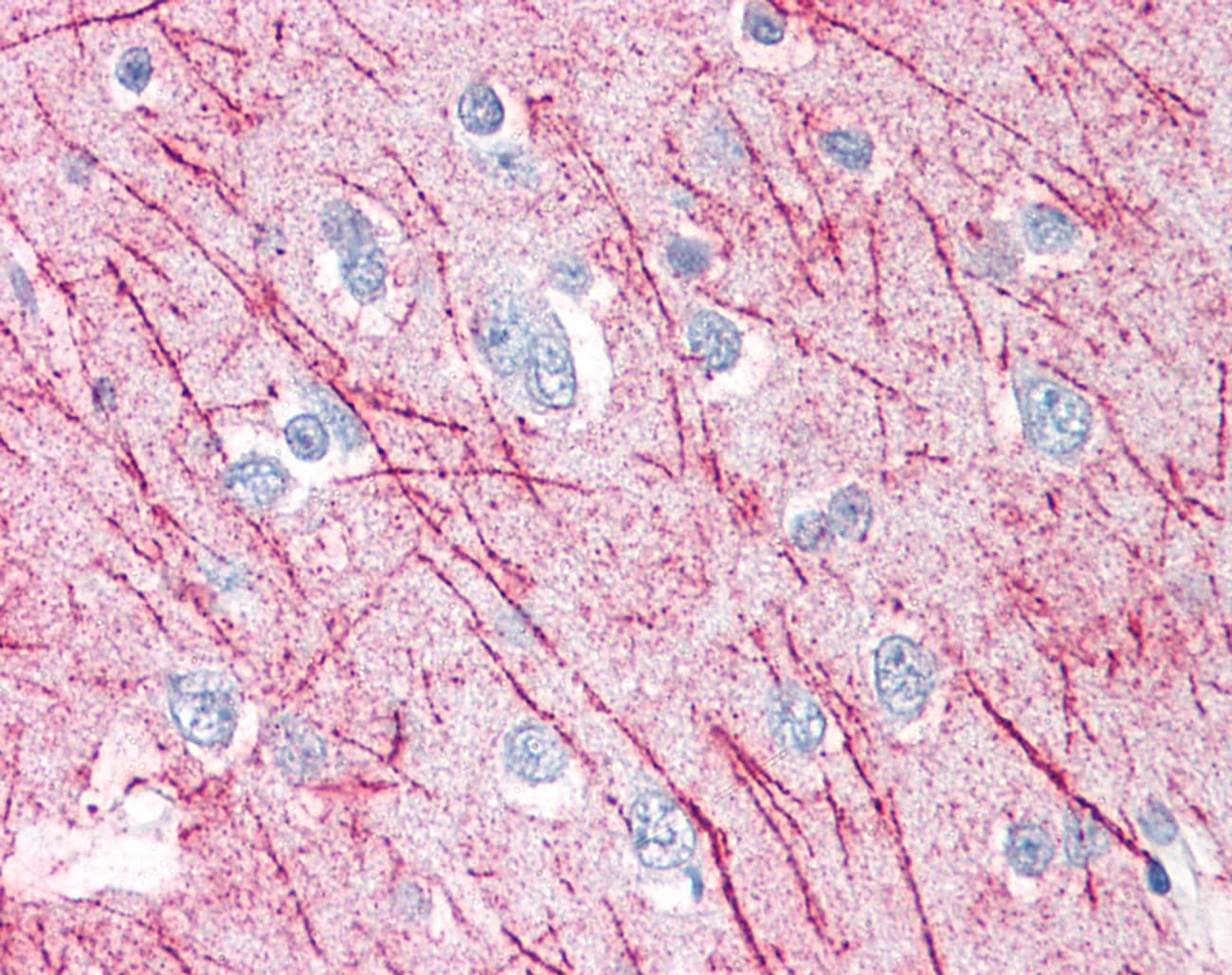 IHC-plus™ Polyclonal Rabbit anti-Human SRPX2 Antibody (Internal, IHC)